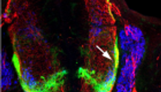 طفرة جينية تعوق التواصل بين المخ والعضلات