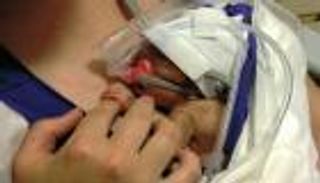 ارتفاع فرص نجاة الأطفال "الخدج"