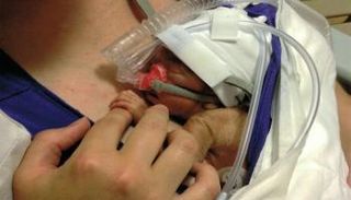 فرص نجاة الأطفال الخدج ترتفع في ظل التقدم الطبي - صورة أرشيفية