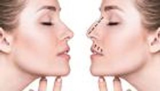 تستغرق 5 دقائق.. تقنية تجميل تعيد تشكيل الأنف دون جراحة