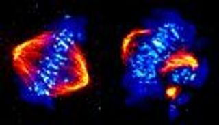 اكتشاف يمهد للسيطرة على سرطان المبيض والبروستاتا