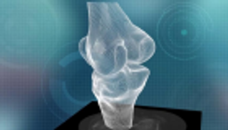 دبي تحتضن أول مركز في الشرق الأوسط لاستبدال الركبة بتقنية 3D