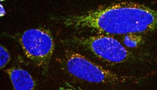 الباحثون صمموا مستشعرات تضيء عندما ترتبط بجزيئات تأكلها الخلايا 