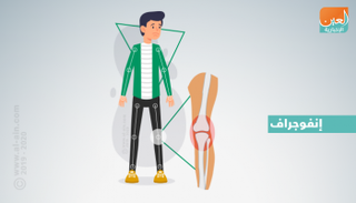 خشونة الركبة تعيق الحركة وتسبب آلاما مبرحة