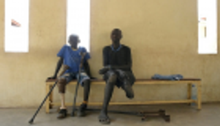 عشرات الآلاف بأطراف مبتورة في جنوب السودان.. وسوء الطرق يعرقل الوصول للعلاج