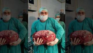 أطباء يستأصلون ورما في حجم البطيخة من بطن فتاة