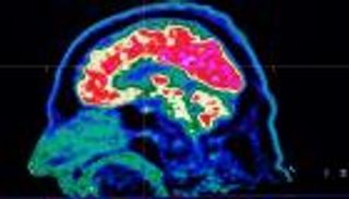 ابتكار آلية جديدة تحول الأفكار إلى كلمات