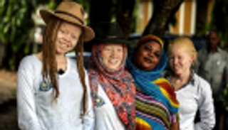 نبش قبور مصابين بالمهق في تنزانيا.. طقوس لجلب الثروة والسلطة