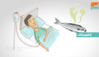 إنفوجراف.. 7 أعراض للتسمم من الفسيخ