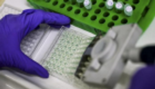 "الصحة الجزائرية" تسجّل 10 آلاف إصابة بالحصبة منذ بداية 2019