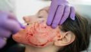 إغلاق مركز تجميل في أمريكا بعد إصابة 2 بالإيدز