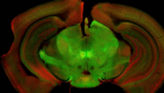 اكتشاف وظيفة خليتين في "المادة السوداء" بالدماغ