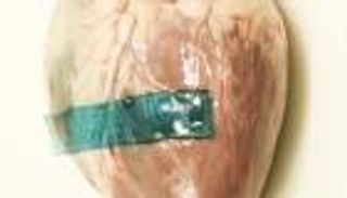 غراء طبيعي يصلح جروح القلب دون غرز