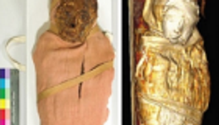 اكتشاف إصابة مومياء طفل مصري بالسل 