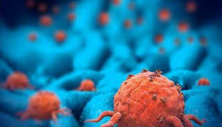 جانب من اختبار علاج الورم.