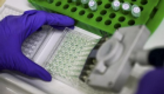 الحصبة تهاجم 25 ولاية أمريكية