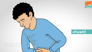 إنفوجراف يبين أسباب غازات البطن 