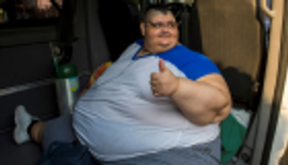 البدناء الأقرب لخطر الوفاة في جراحات القلب