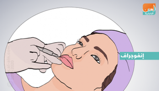 حقن الفيلر بديل آمن لعمليات التجميل 