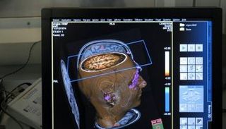 3 أرباع المرضى في فرنسا يرفضون فحوصات تقنيات الذكاء الاصطناعي