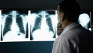 خطة صينية للقضاء على السل خلال 3 سنوات