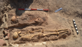 تسجيل أقدم إصابة بـ"اللوكيميا" في مصر القديمة