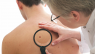 جهاز محمول لتشخيص سرطان الجلد