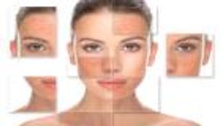 حمض الساليسيليك.. مركب ساحر للتخلص من الندوب