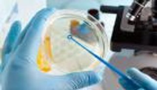 تقنية واعدة تكشف البكتيريا المقاومة للعقاقير في 30 ثانية