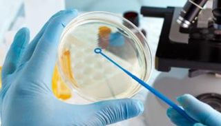 التقنية الجديدة تحد من مقاومة البكتيريا للمضادات الحيوية - أرشيفية