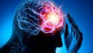 انخفاض الكوليسترول يهدد بـ"انفجار" في المخ