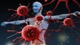 سرطان الرئة.. علاج صيني ينتصر على المرض