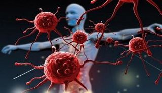 باحثون صينيون يطورون علاجا جديدا لسرطان الرئة