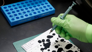 فني تحليل مستندات يجمع عينات من الحبر