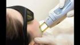 4 إجراءات ضرورية خلال جلسات إزالة الشعر بالليزر