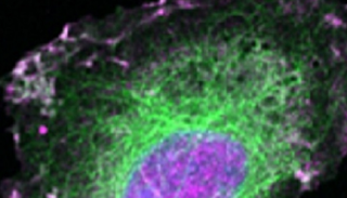 اللون البنفسجي يشير إلى بروتين "ران"
