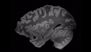 100 ساعة بـ"الرنين المغناطيسي" تكشف أسرار الدماغ