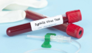 مرض الزهري يصيب 260 ألفا في أوروبا