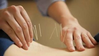 العلاج بالطب الصيني أحد أهم أسباب طول أعمار الصينيين - أرشيفية