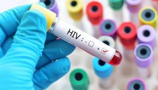 العلماء ما زالوا يبحثون عن علاج فعال ضد الإيدز