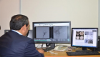 إنجاز طبي أردني في علاج تشوهات شرايين الدماغ