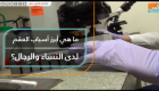 أبرز أسباب العقم لدى النساء والرجال