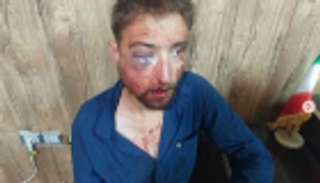 الاعتداء على سائح ألماني بإيران.. كسر في فكه ووجهه