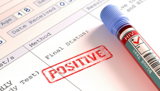 أكثر من 7 ملايين في جنوب أفريقيا مصابون بالإيدز