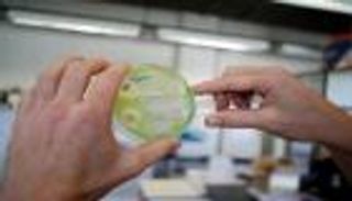 حل لغز انتشار بكتيريا المضادات الحيوية في أوروبا