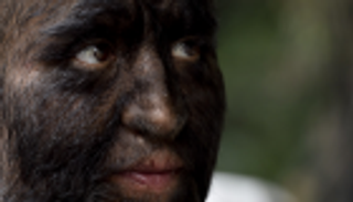 دواء يحول الأطفال لـ"أشباه ذئاب".. ذعر في إسبانيا