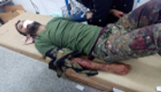 نجاة قائد قوات الحزام الأمني في عدن من محاولة اغتيال