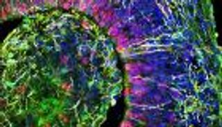 كهرباء في أدمغة مطورة مخبريا.. أمل جديد لعلاج الأمراض العصبية