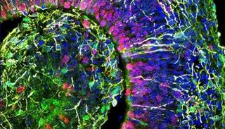 تسجيل نشاط كهربائي في أدمغة مطوّرة مخبريا في سابقة علمية