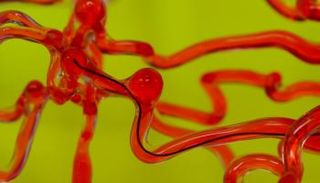 الروبوت الدودة يزيل الجلطات